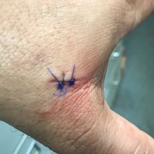 Meet your Posher, Lynn